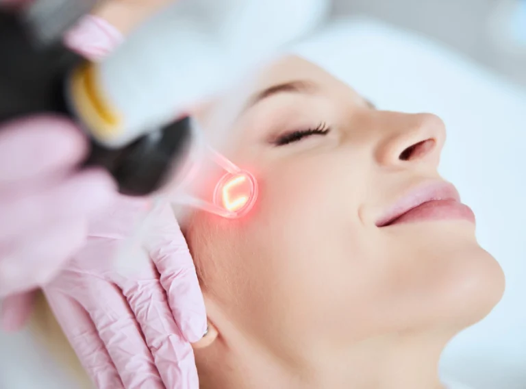 Laser-resurfacing